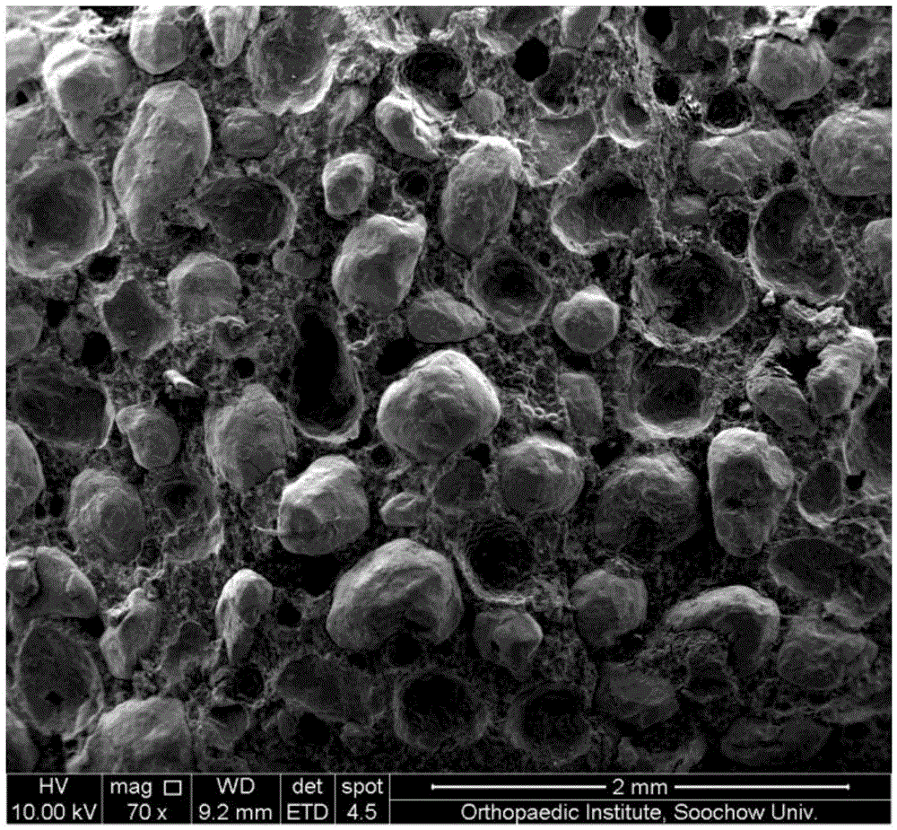 Acrylic compound bone cement with partial degradation function and preparation method of acrylic compound bone cement with partial degradation function
