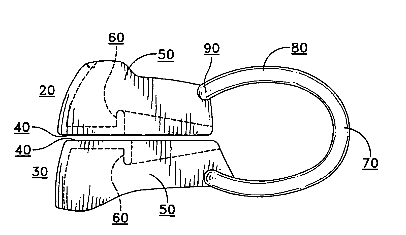 Anterior sextant dental bite tray apparatus