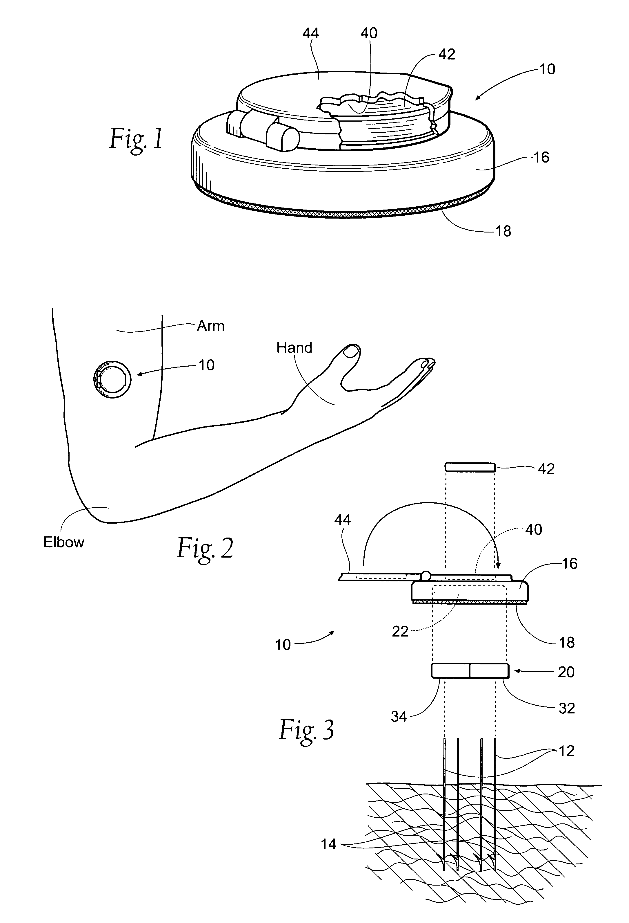 Portable percutaneous assemblies, systems and methods for providing highly selective functional or therapeutic neuromuscular stimulation