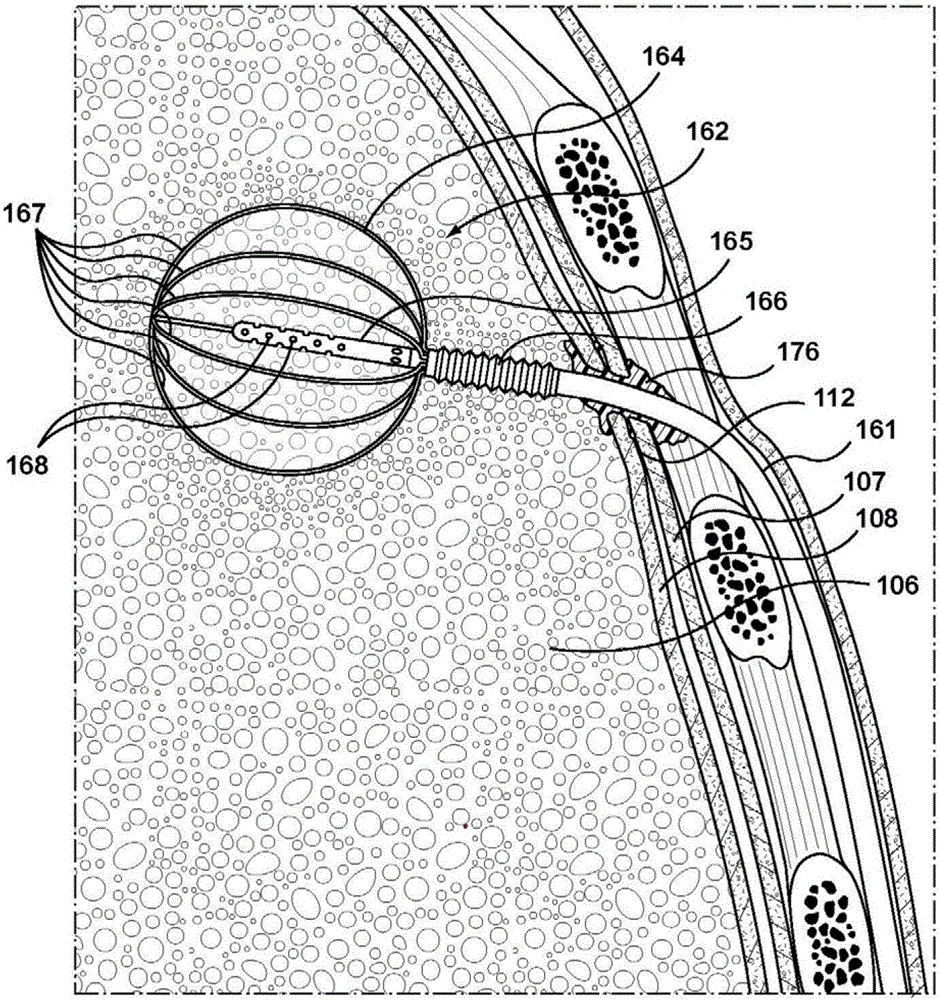 Methods and devices for treating a hyper-inflated lung