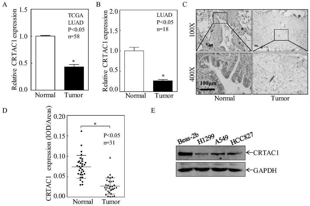 Target CRTAC1 for inhibiting lung adenocarcinoma and application of target CRTAC1