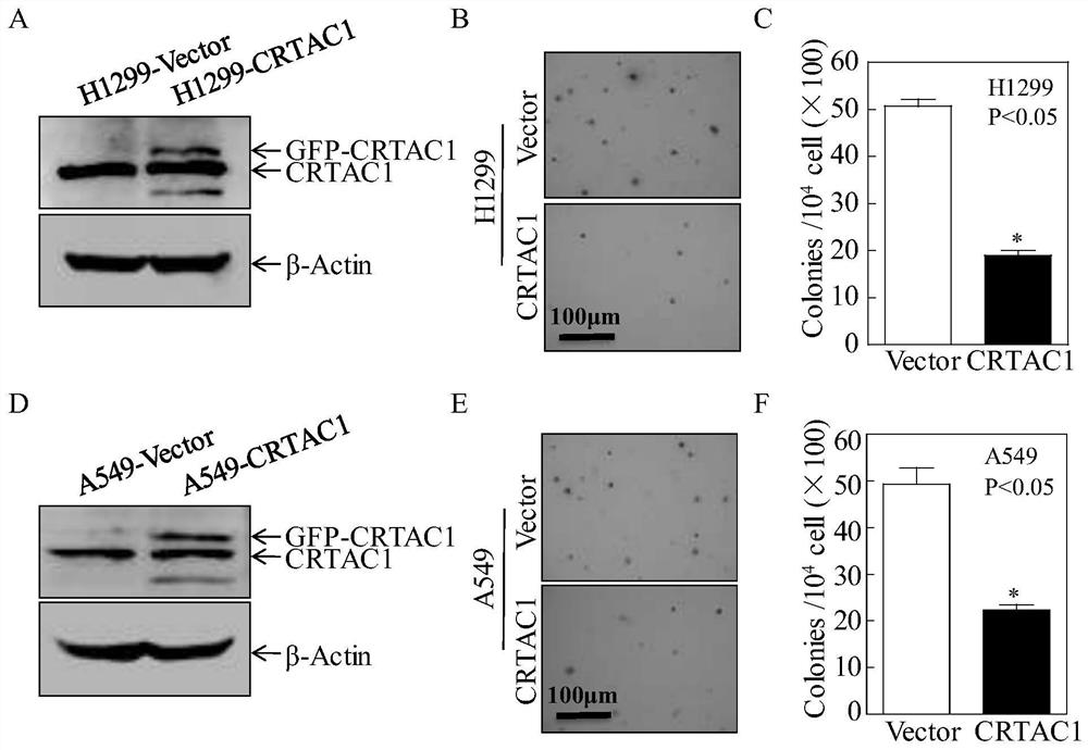 Target CRTAC1 for inhibiting lung adenocarcinoma and application of target CRTAC1