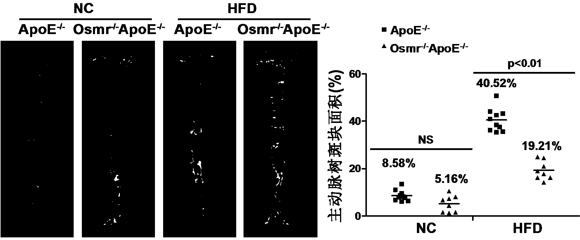 Function and application of II-type oncostatin M receptor in treating atherosclerosis