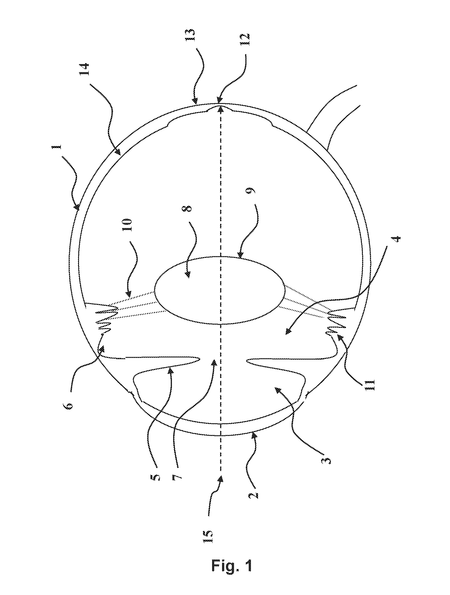 Intraocular Lens System