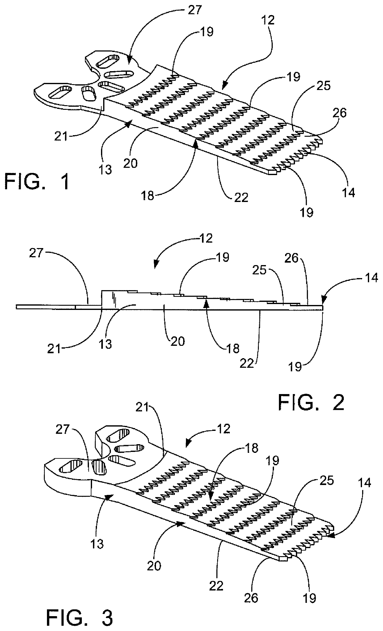 Surgical saw blade and method for wedge osteotomies