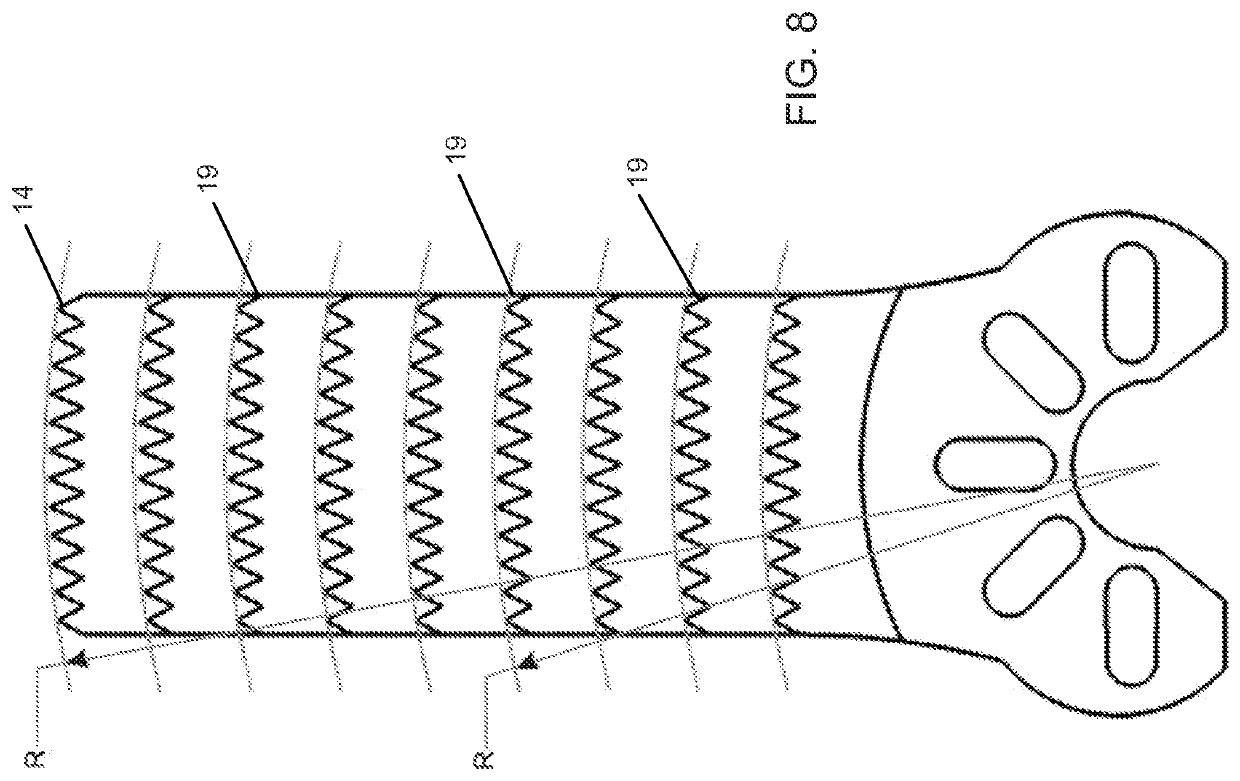 Surgical saw blade and method for wedge osteotomies