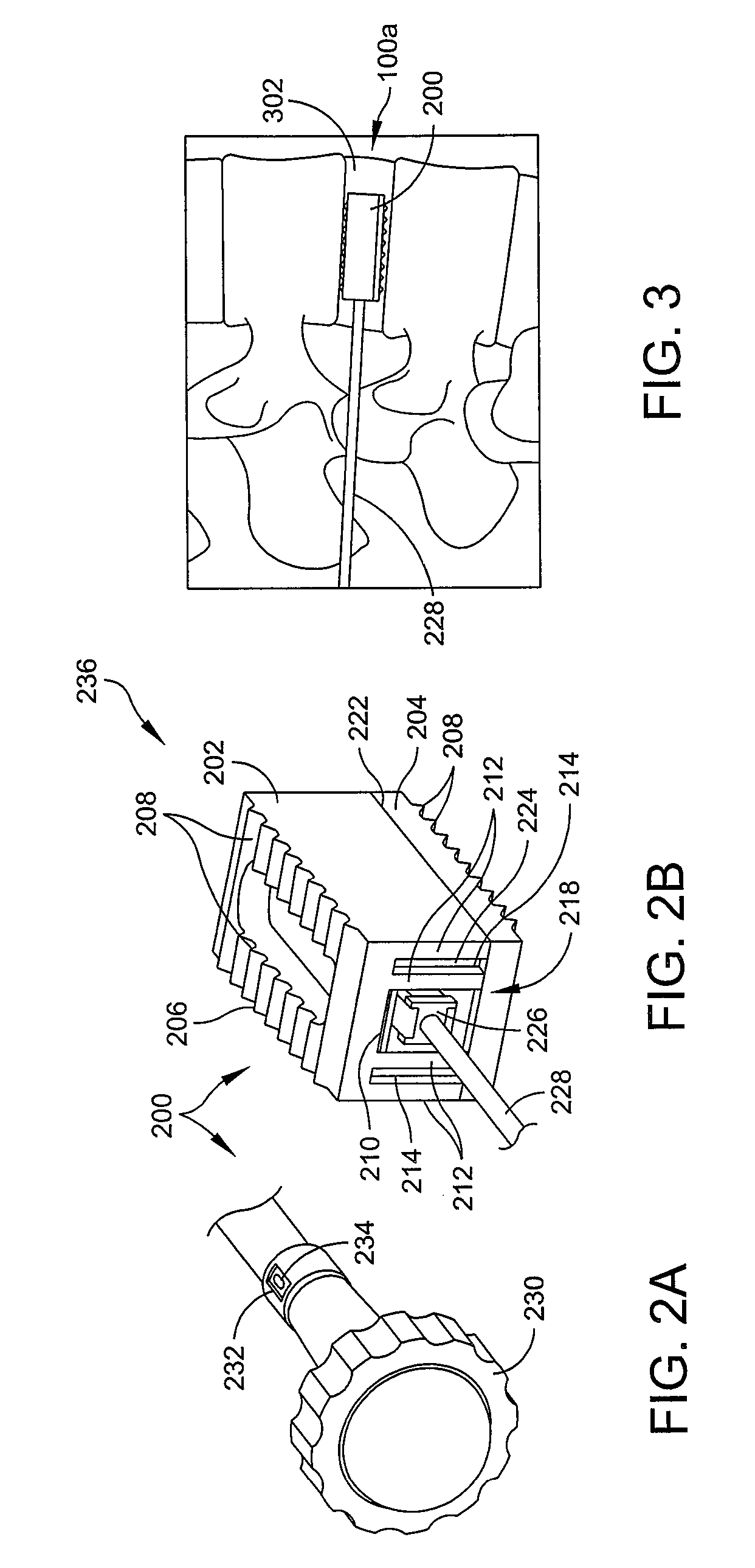 Expandable spinal fusion cage
