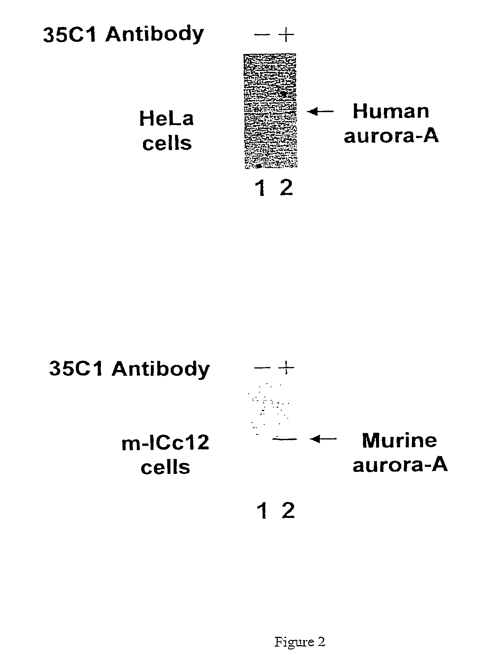 Anti-aurora-A monoclonal antibody, method for obtaining same and uses thereof for diagnosing and treating cancers