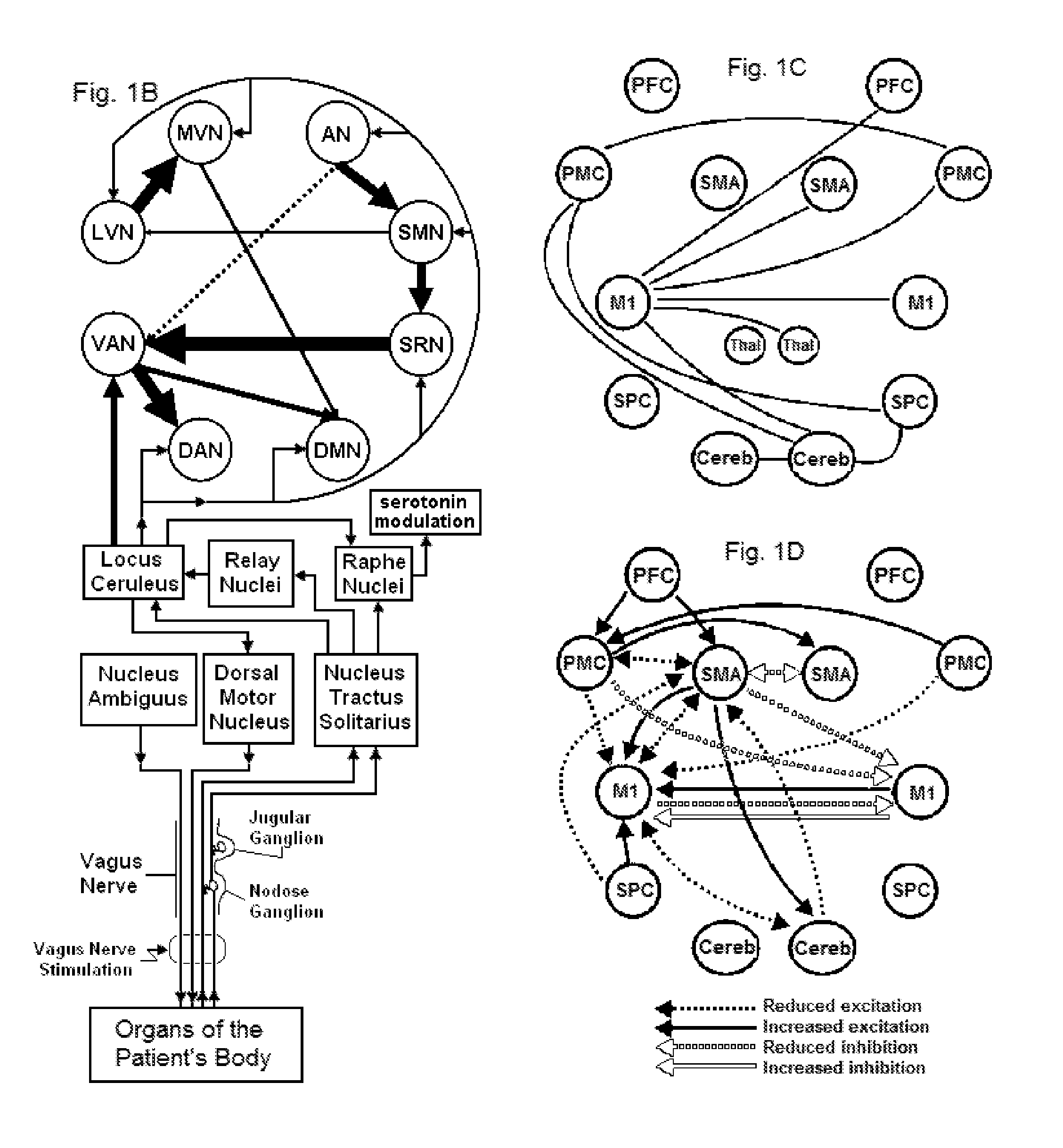 Systems and methods for vagal nerve stimulation
