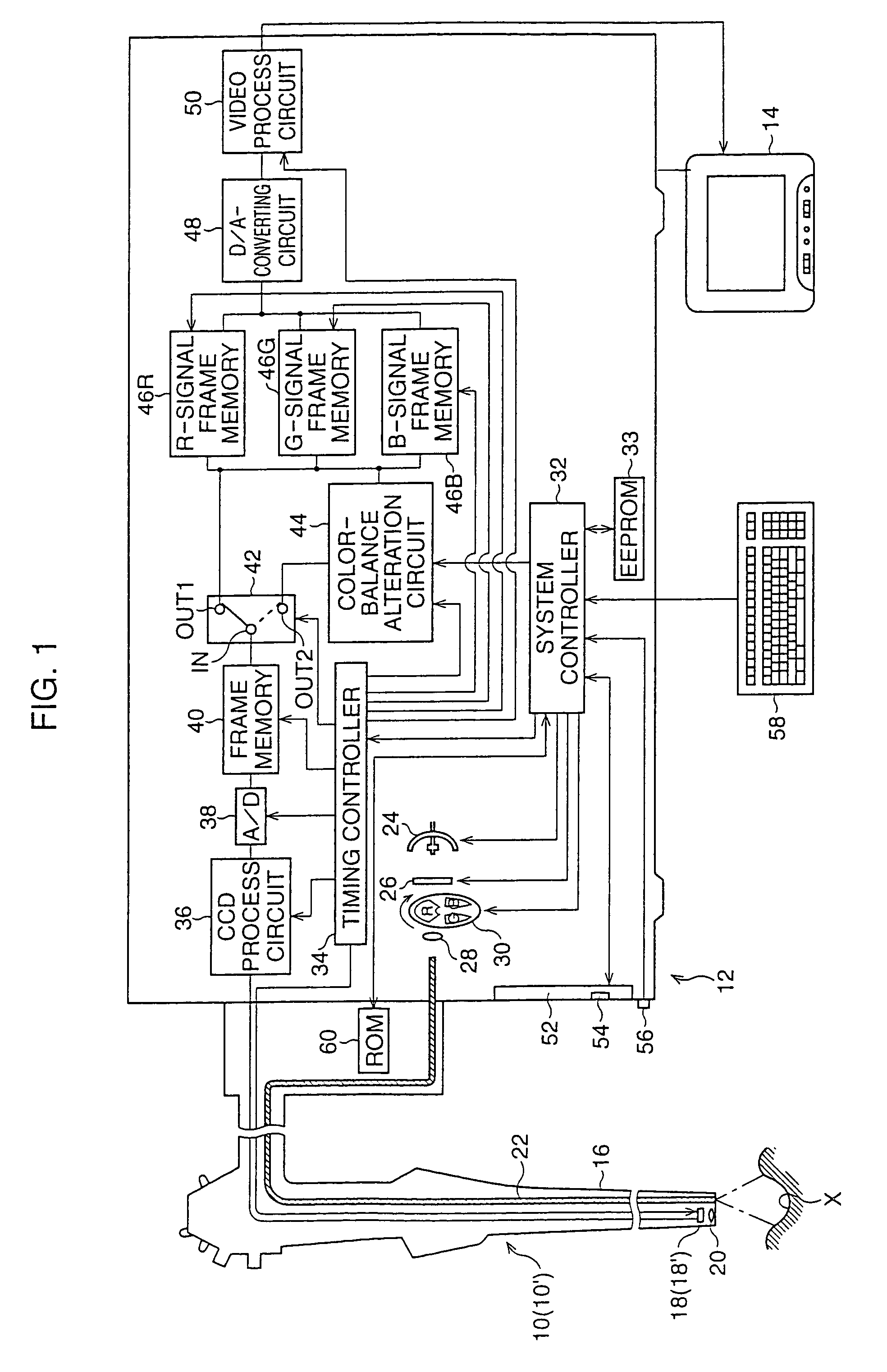 Electronic endoscope system with color-balance alteration process