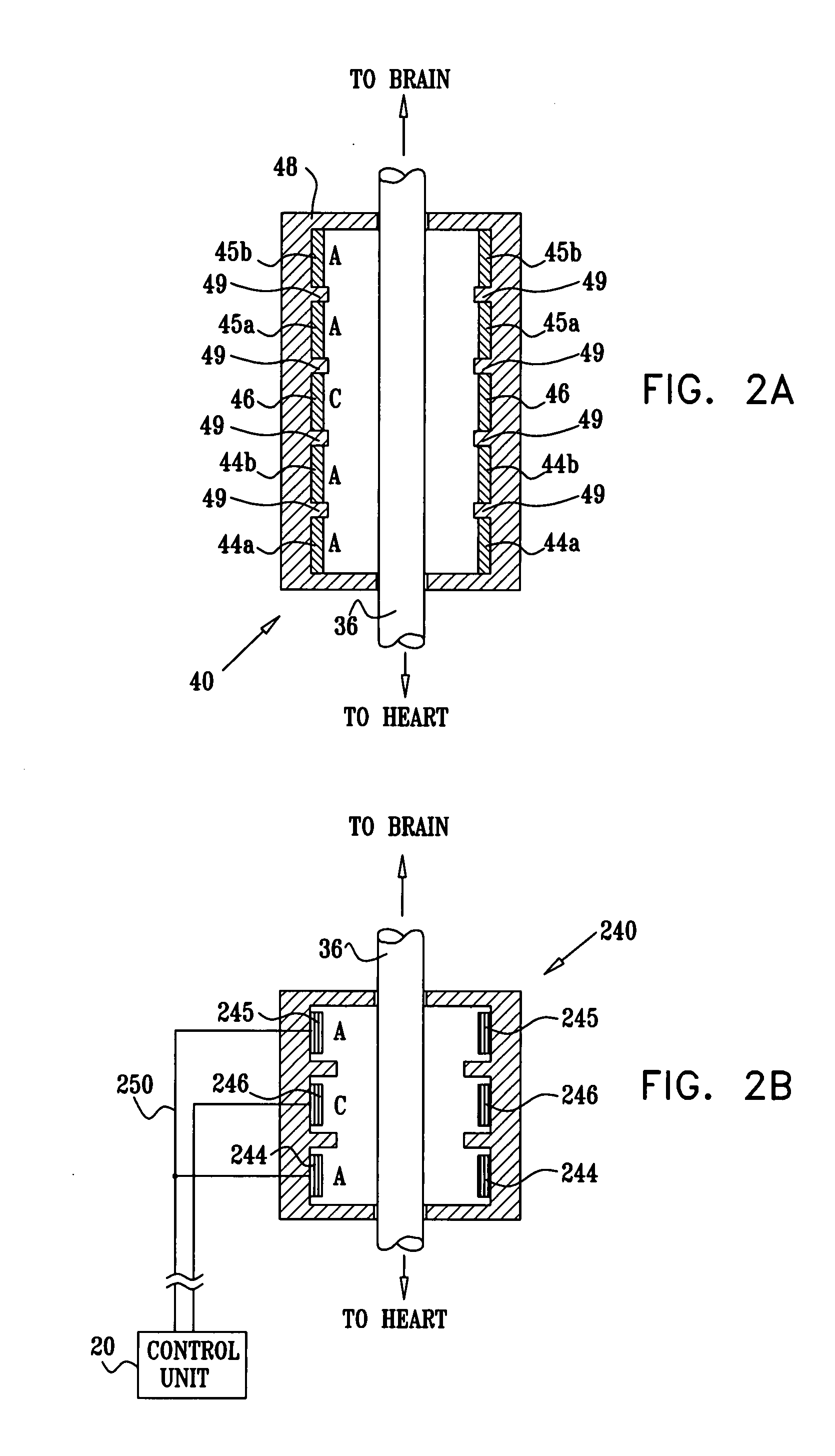 Method for surgically implanting an electrode device