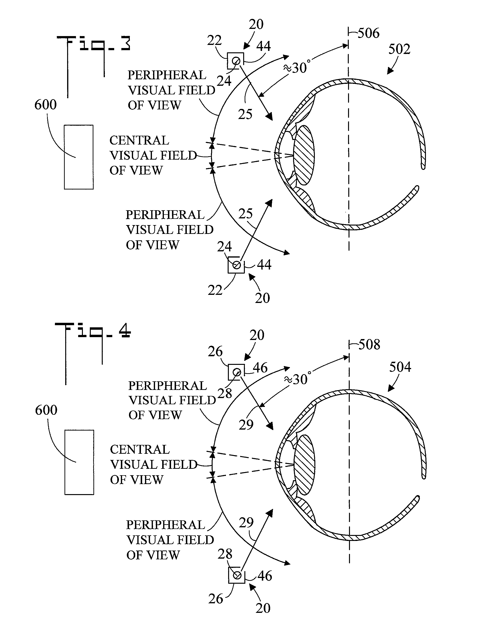 Apparatus and method for preventing photosensitive epilepsy
