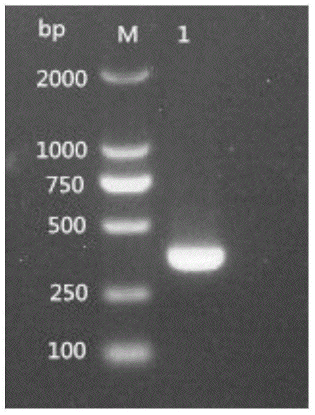 Multiplex PCR kit for simultaneously detecting four viruses carried by ruminants