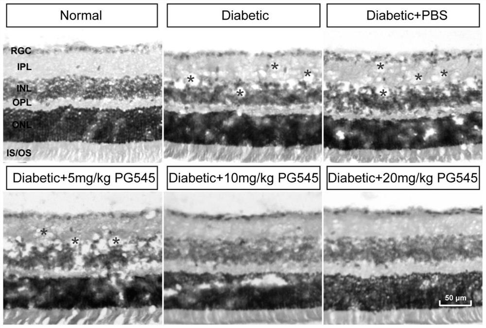 Application of picamod in preparation of medicine for treating diabetic retinopathy