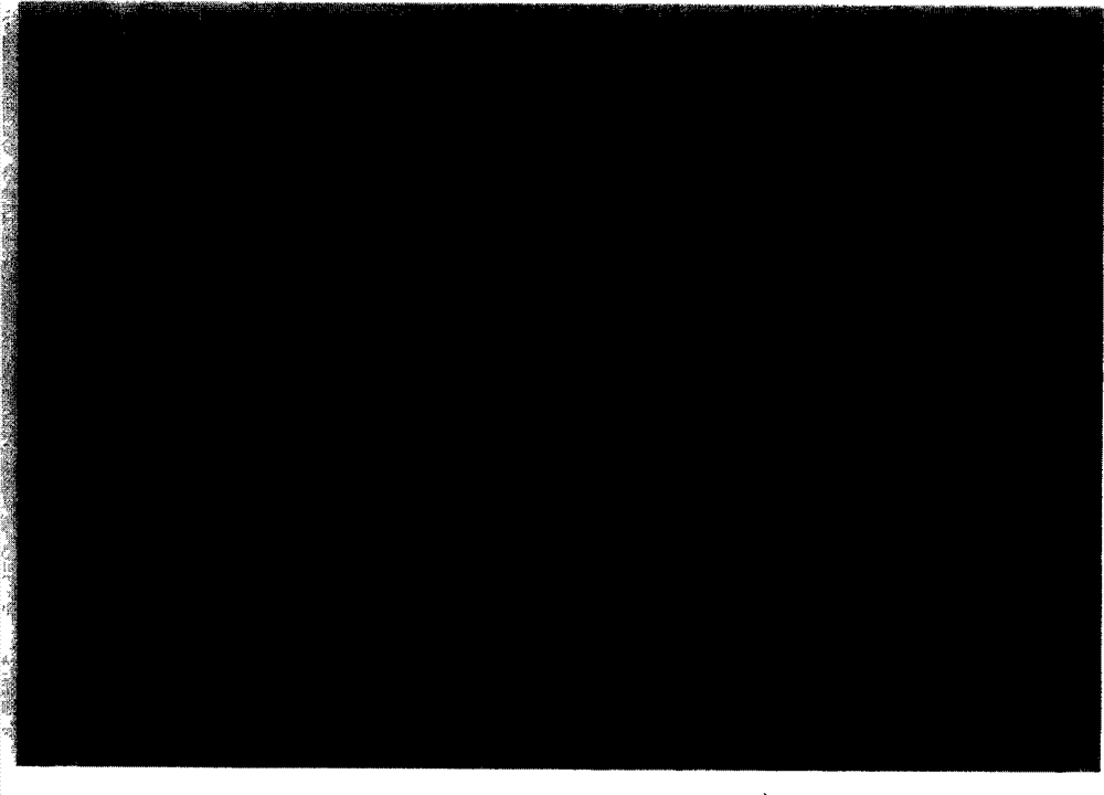 Application of human interferon containing pharmaceutical composition in preparation of medicine for preventing and treating virus infection of respiratory tract