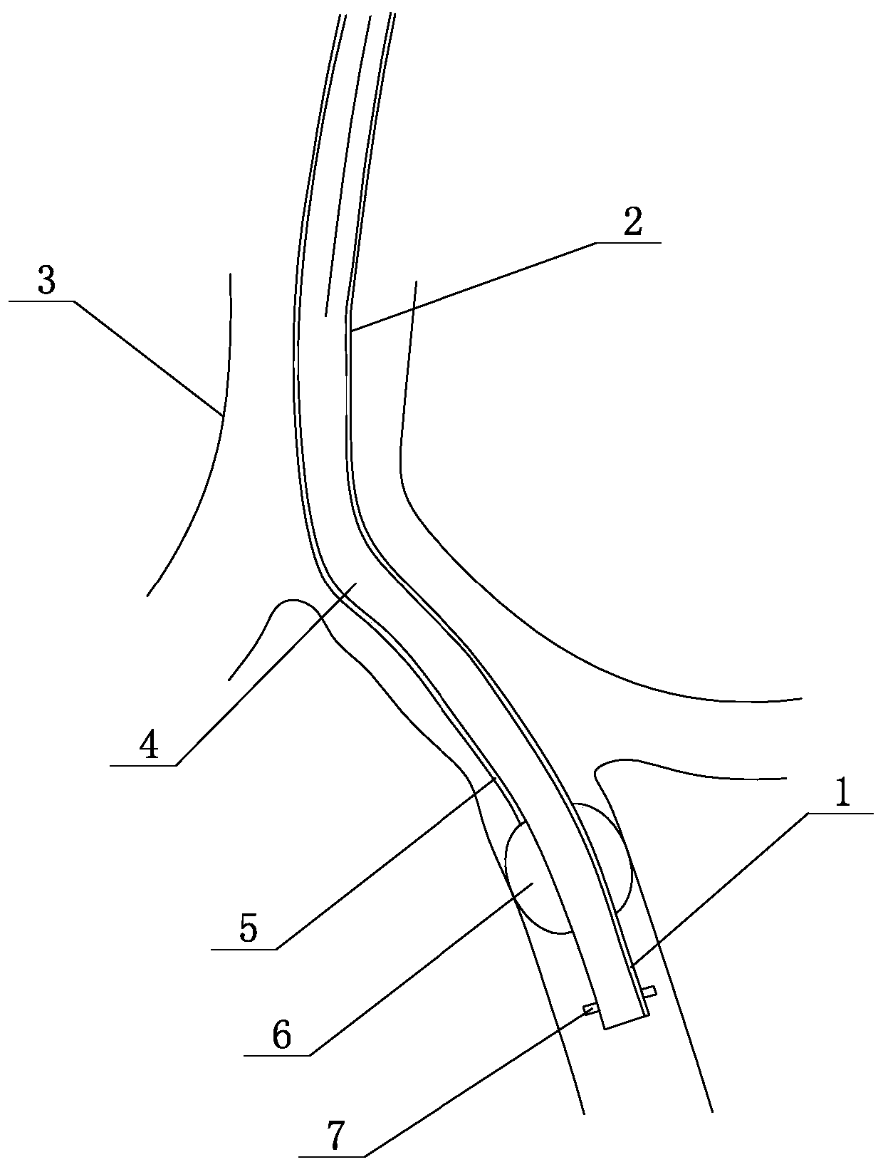 Visual high- selectivity closed bronchus comprehensive treatment device