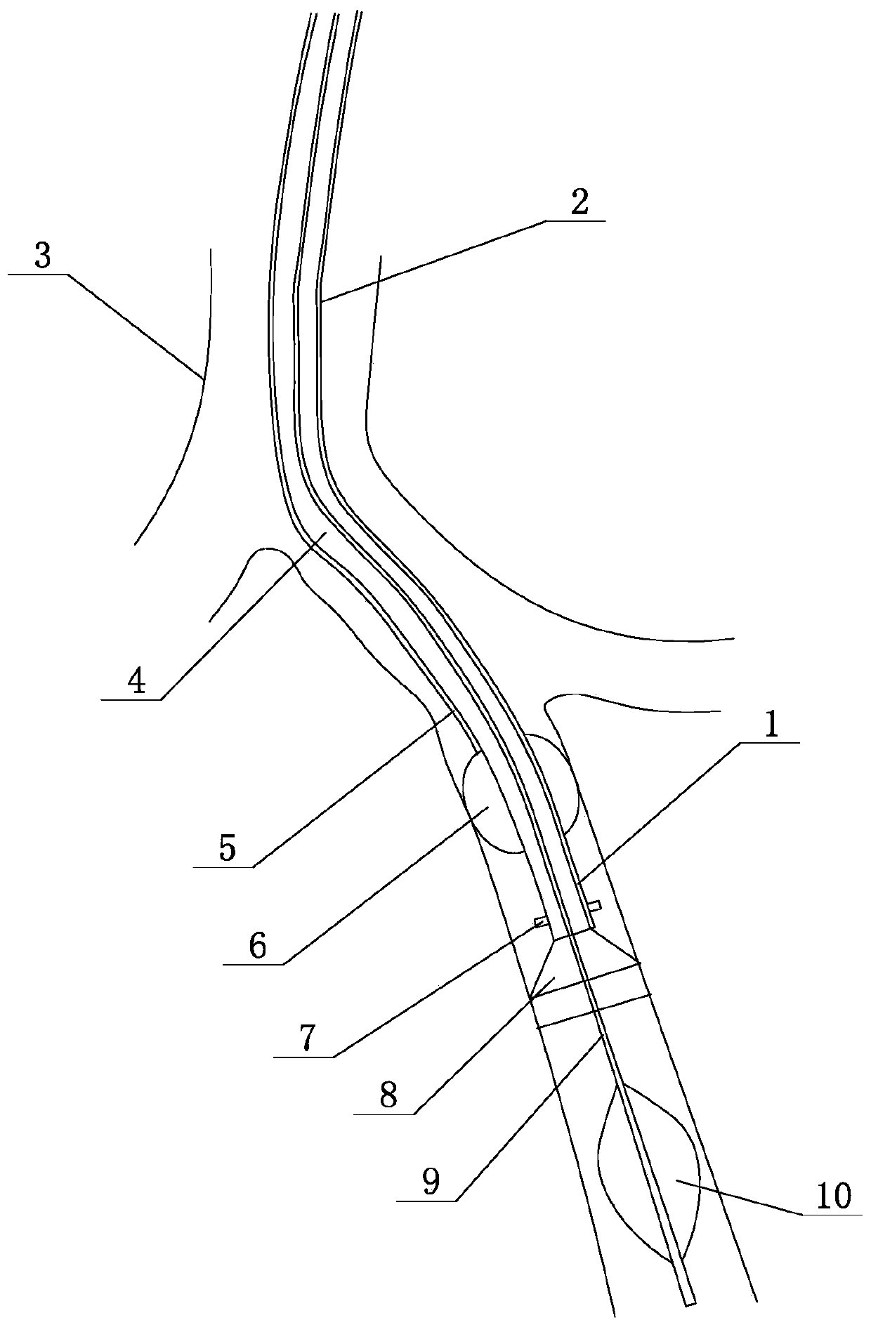 Visual high- selectivity closed bronchus comprehensive treatment device