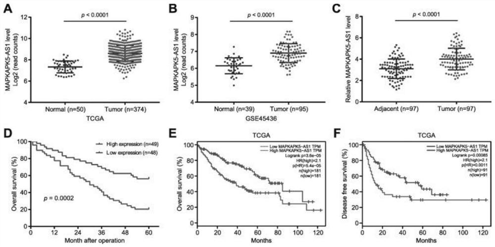 Long non-coding RNA and application thereof in diagnosis and treatment of hepatocellular carcinoma