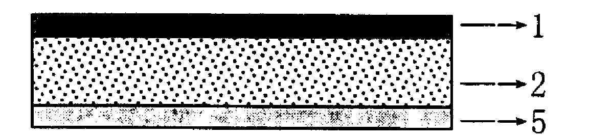 Granisetron and dexamethasone compound percutaneous controlled release patch and preparation method thereof