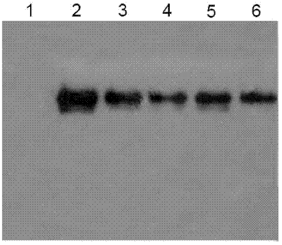 Recombinant food lactic acid bacteria for preventing chronic heavy metal poisioning and preparation method and use thereof