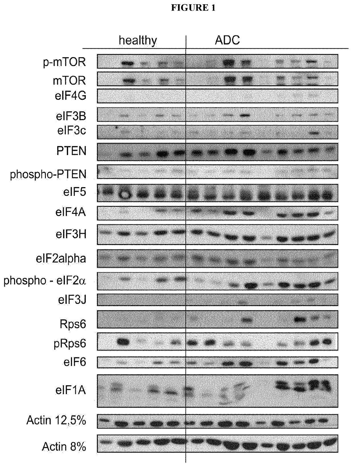 Antitumor compounds and tumor diagnosis