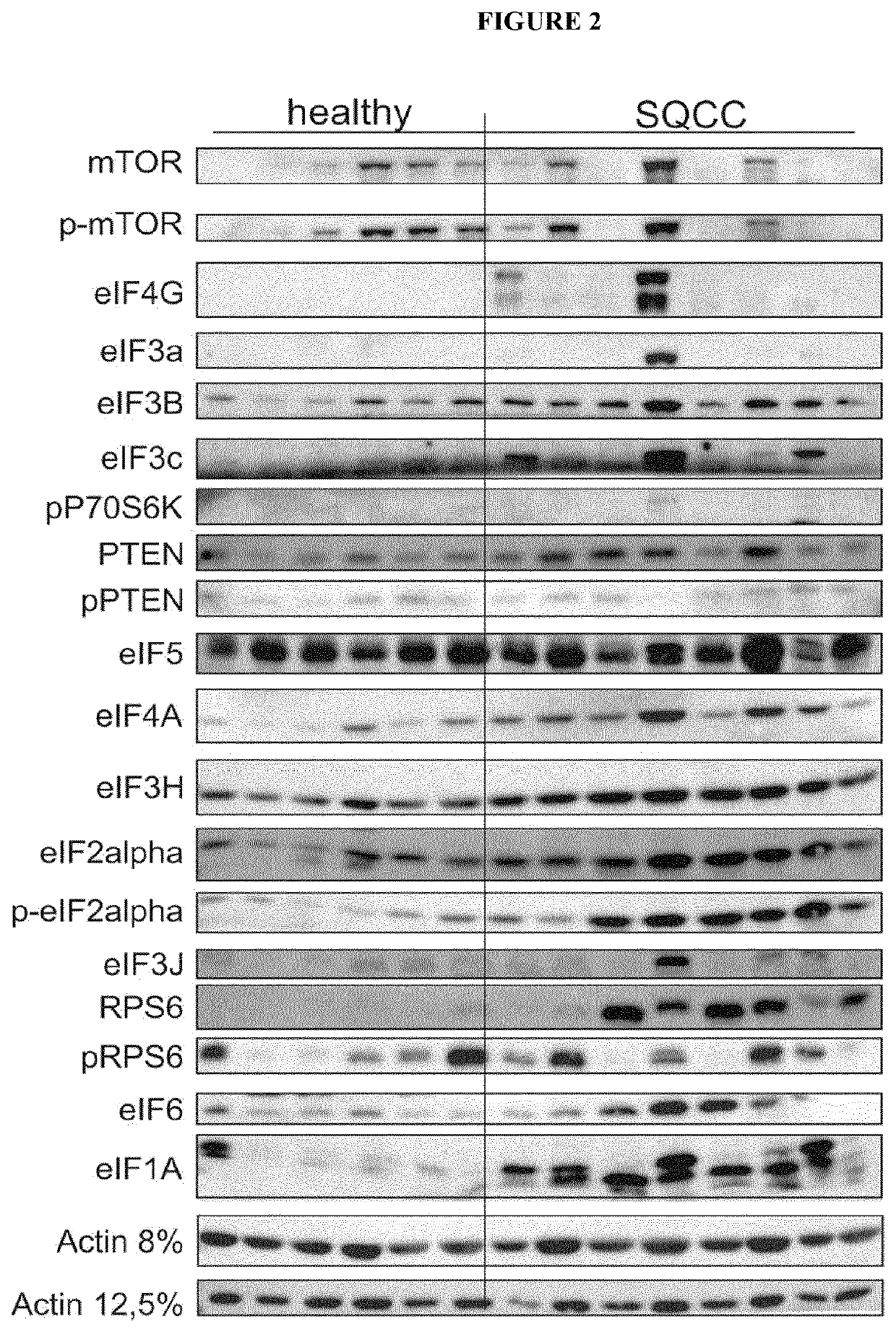 Antitumor compounds and tumor diagnosis