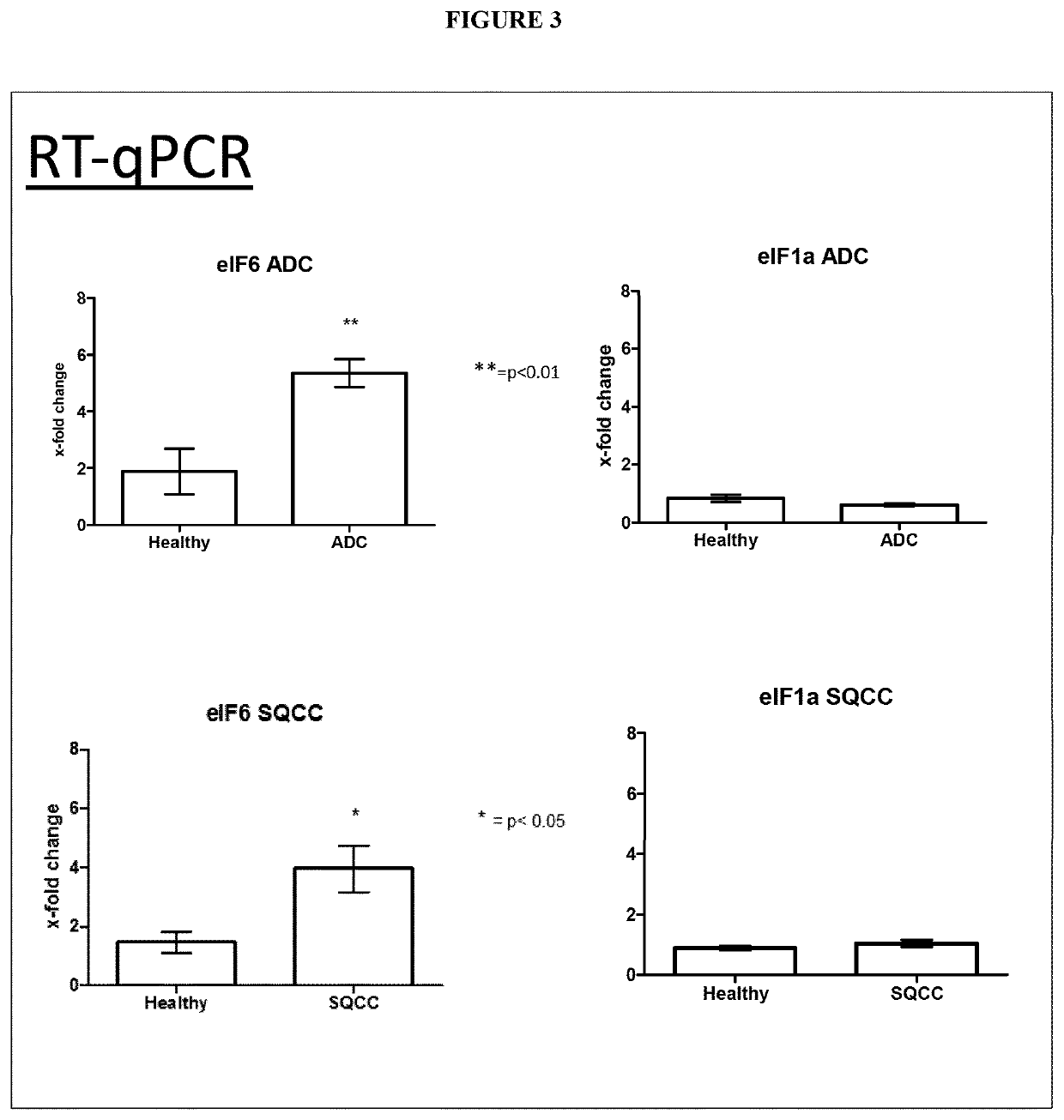 Antitumor compounds and tumor diagnosis