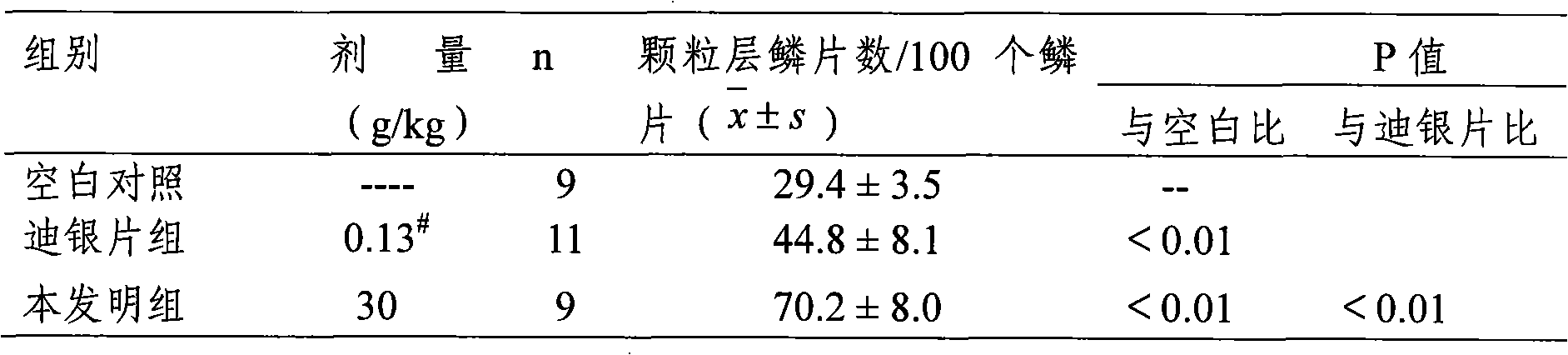 Traditional Chinese medicine composite for treating psoriasis and preparation method thereof