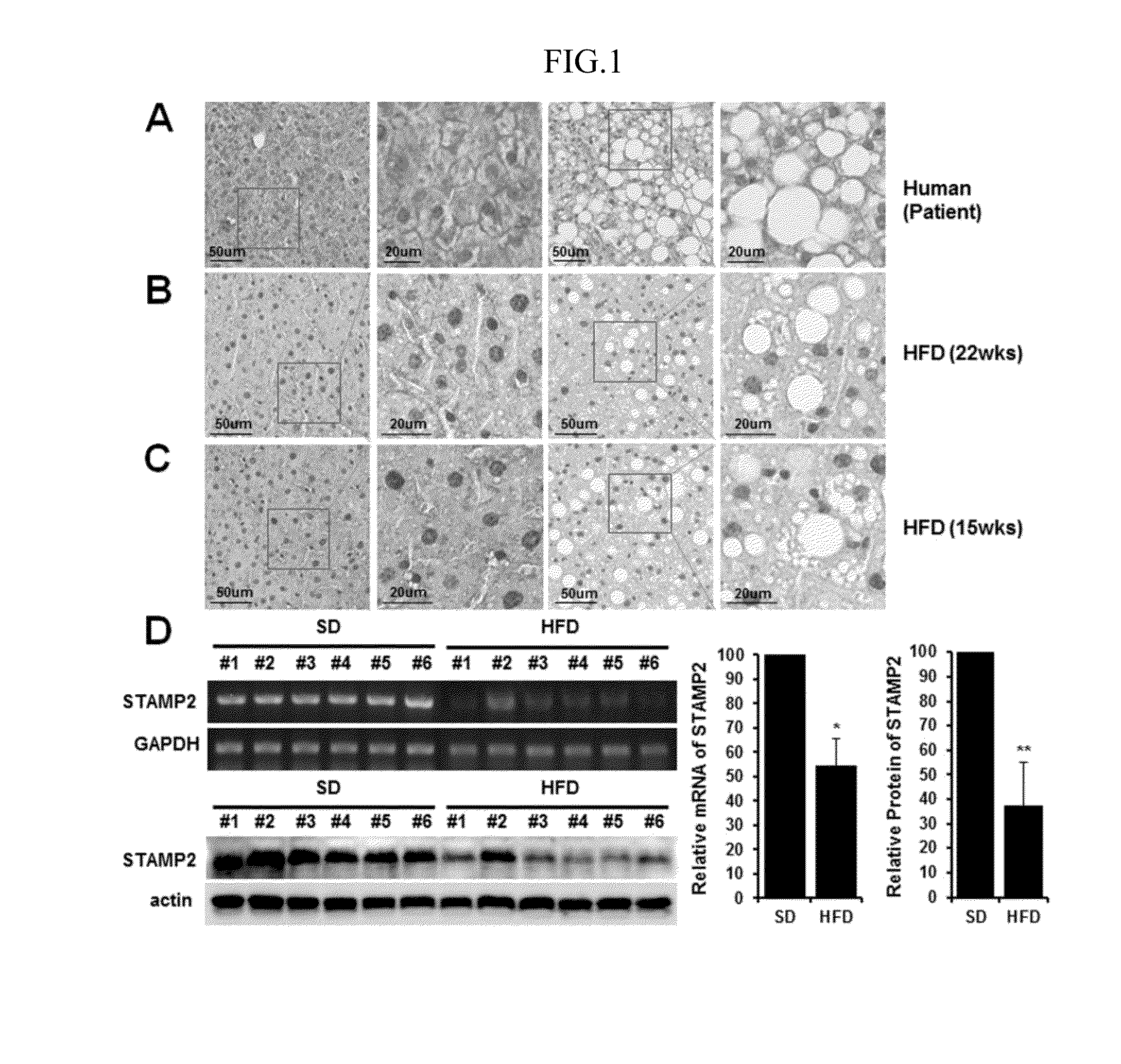 Method for treating or preventing nonalcoholic fatty liver disease