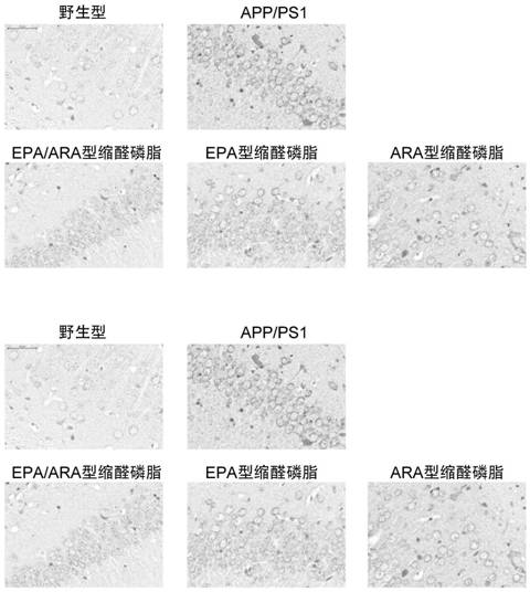 A kind of preparation method and application of epa/ara type plasmalogen