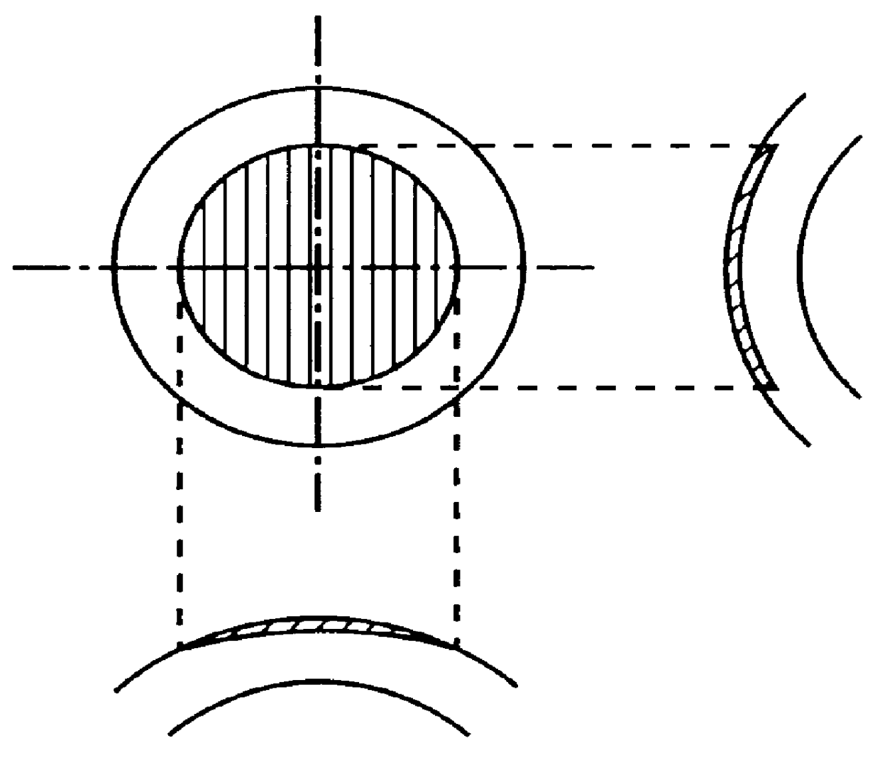 Apparatus for operation on a cornea