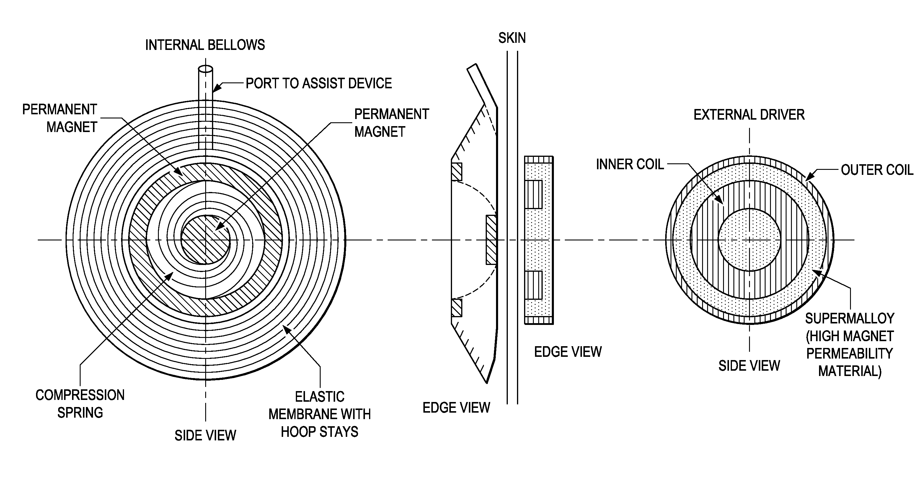 Implantable driver with non-invasive transmural powering device for cardiac assist and combined assist and support devices