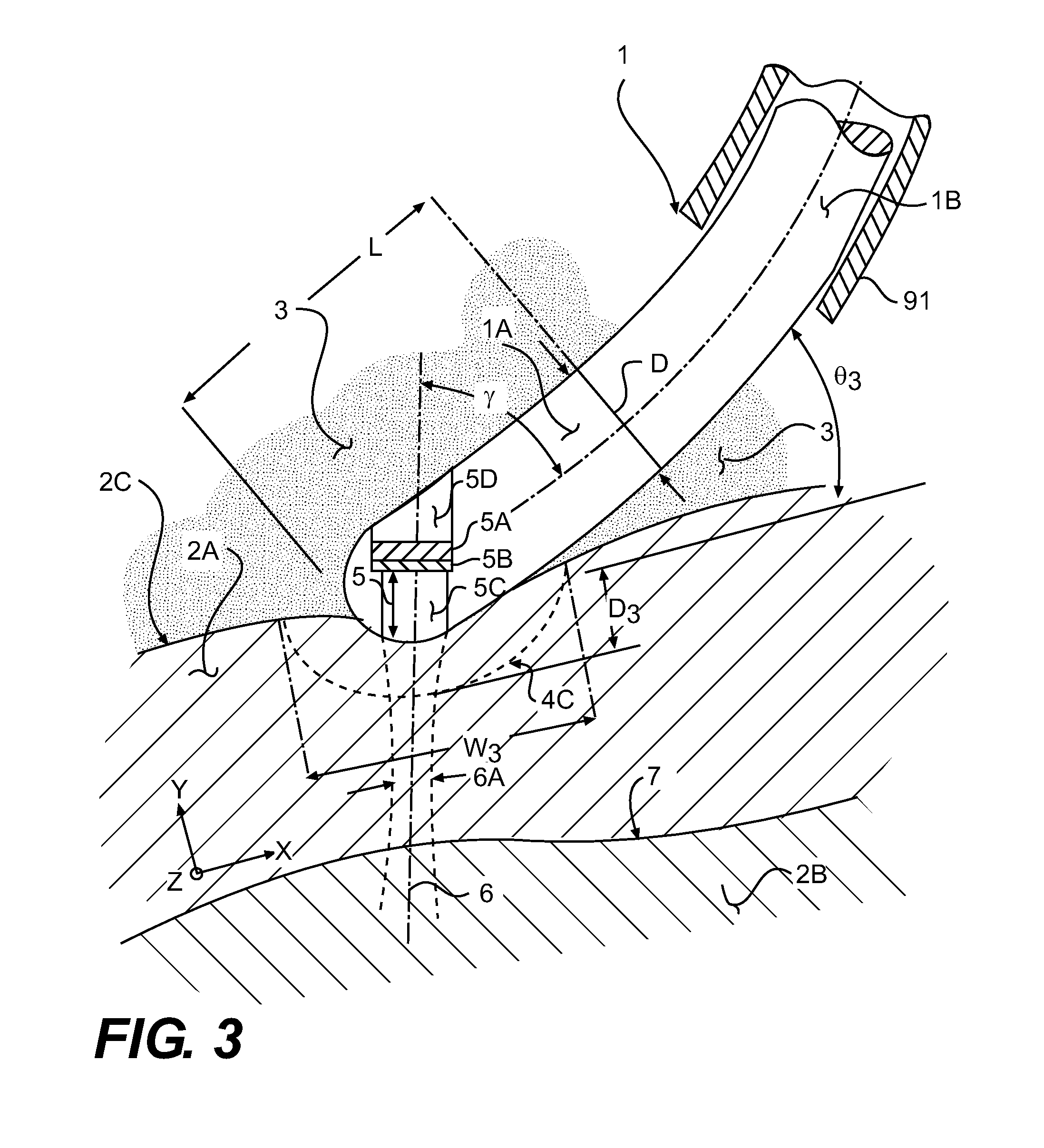 Combination catheter for forward and side lesioning with acoustic lesion feedback capability