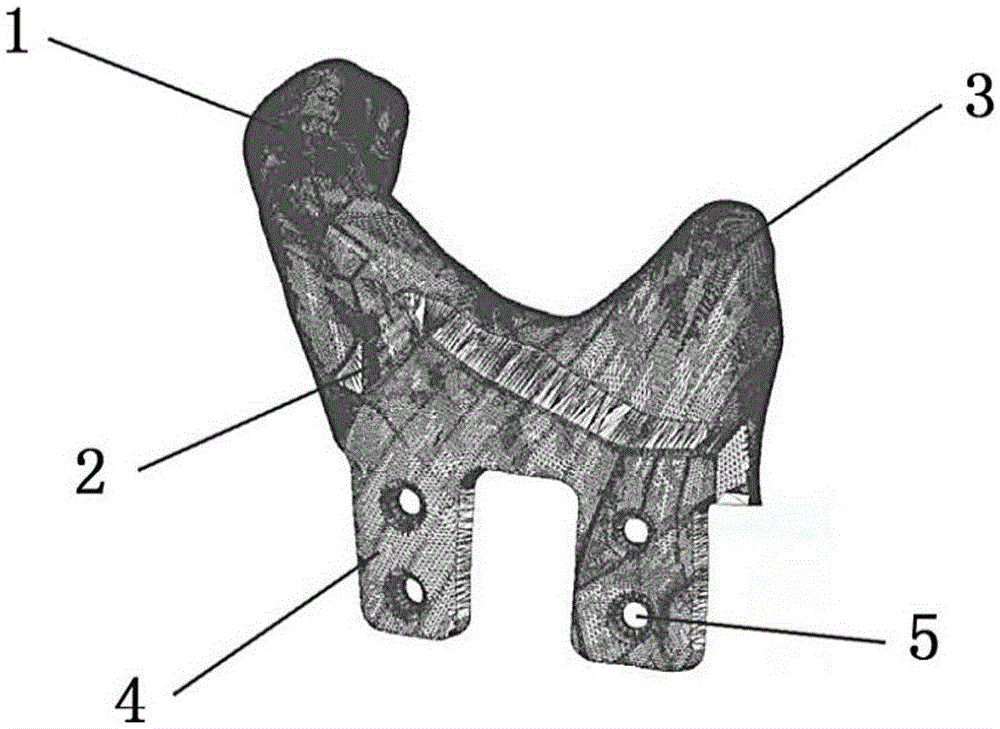 Porous artificial temporal-mandibular joint structure and making method
