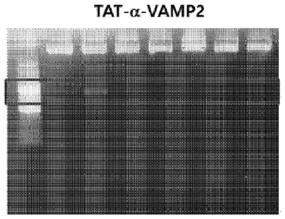 Anti-vamp2 antibody for inhibiting snare complex and use thereof