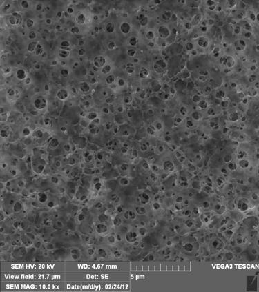 Method for preparing hydrophilic macromolecule microporous composite membrane