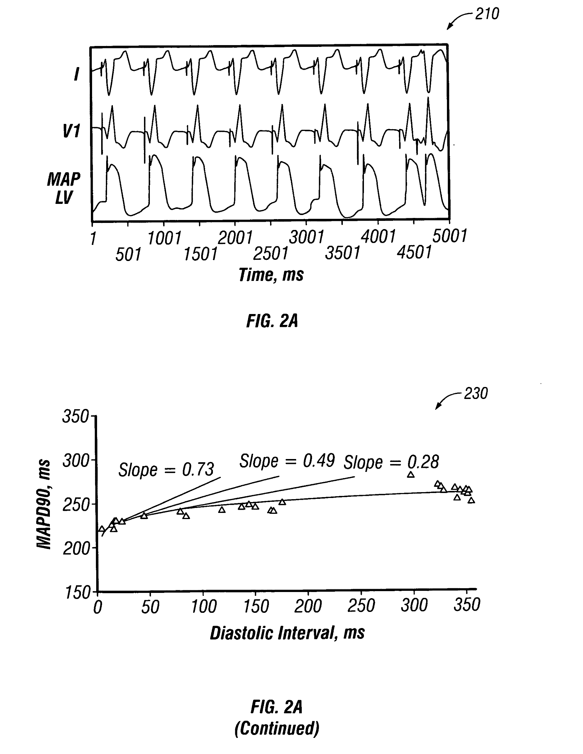 Methods and systems for treating heart instability