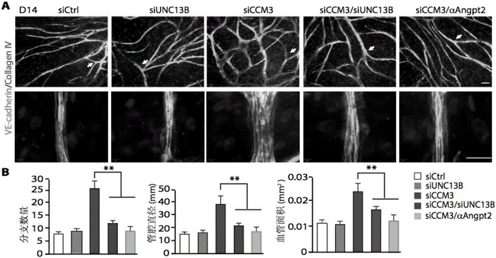 Construction method of cerebral cavernous hemangioma cell model and application of cell model in new drug screening