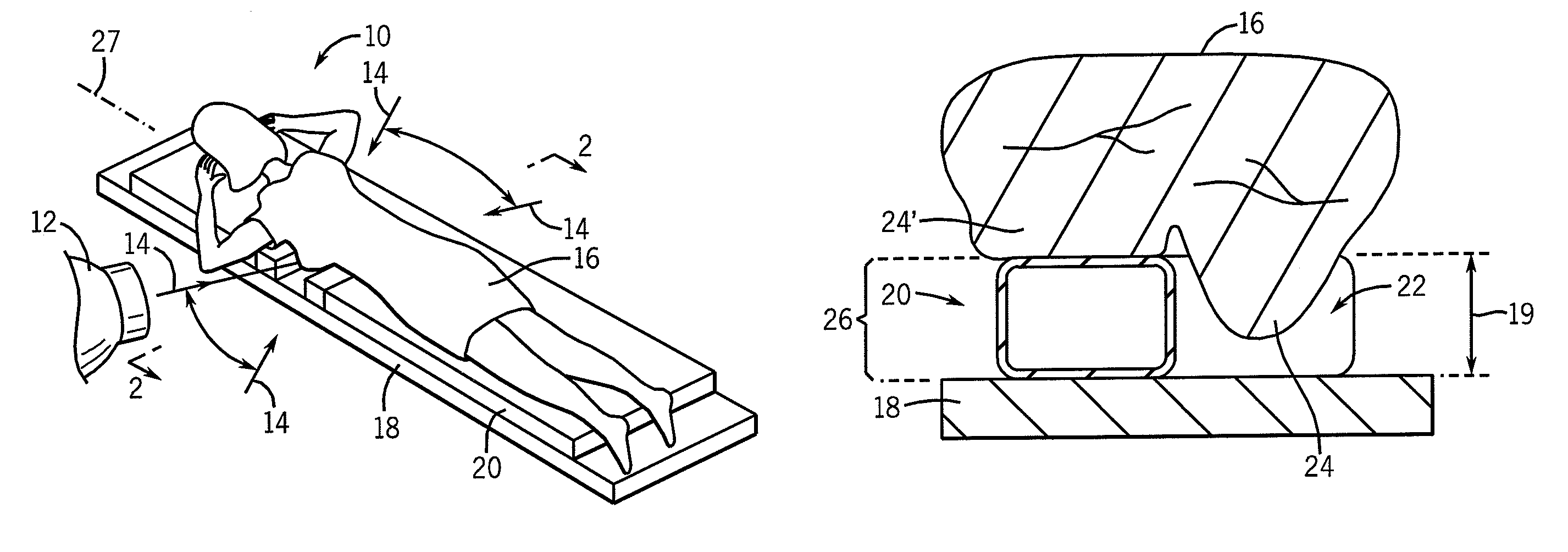 Low skin dose patient positioning device for radiation treatment of prone breast