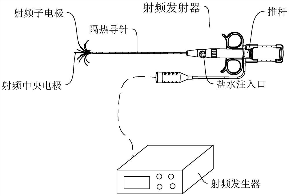 A radio frequency ablation method, system, storage medium and intelligent terminal