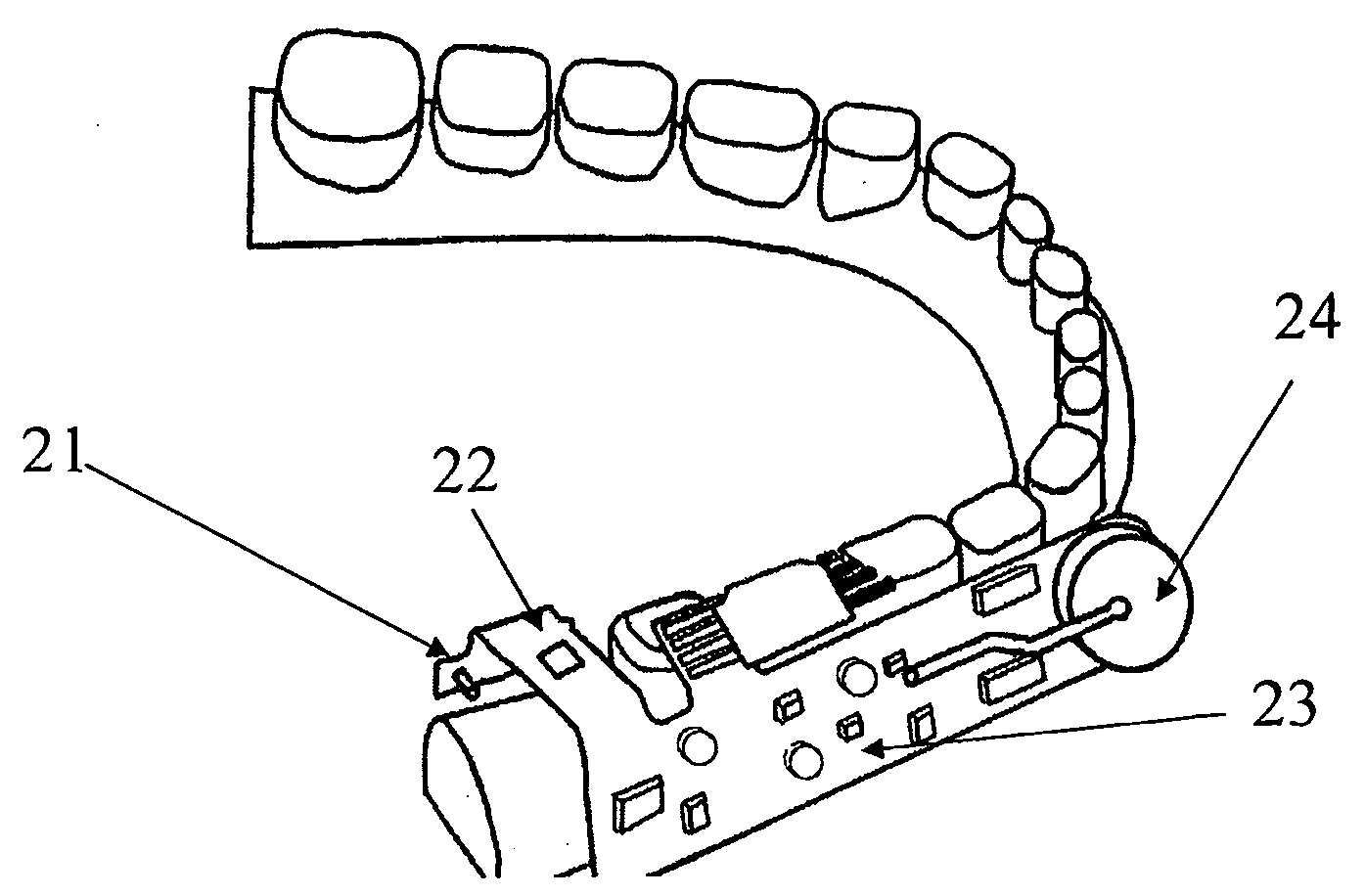 Manufacturing methods, testing methods, and testers for intra-oral electronically embedded devices