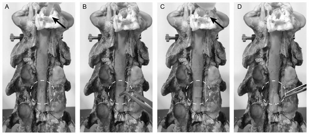 Wet adhesive hydrogel for dura mater repair as well as preparation method and application of wet adhesive hydrogel