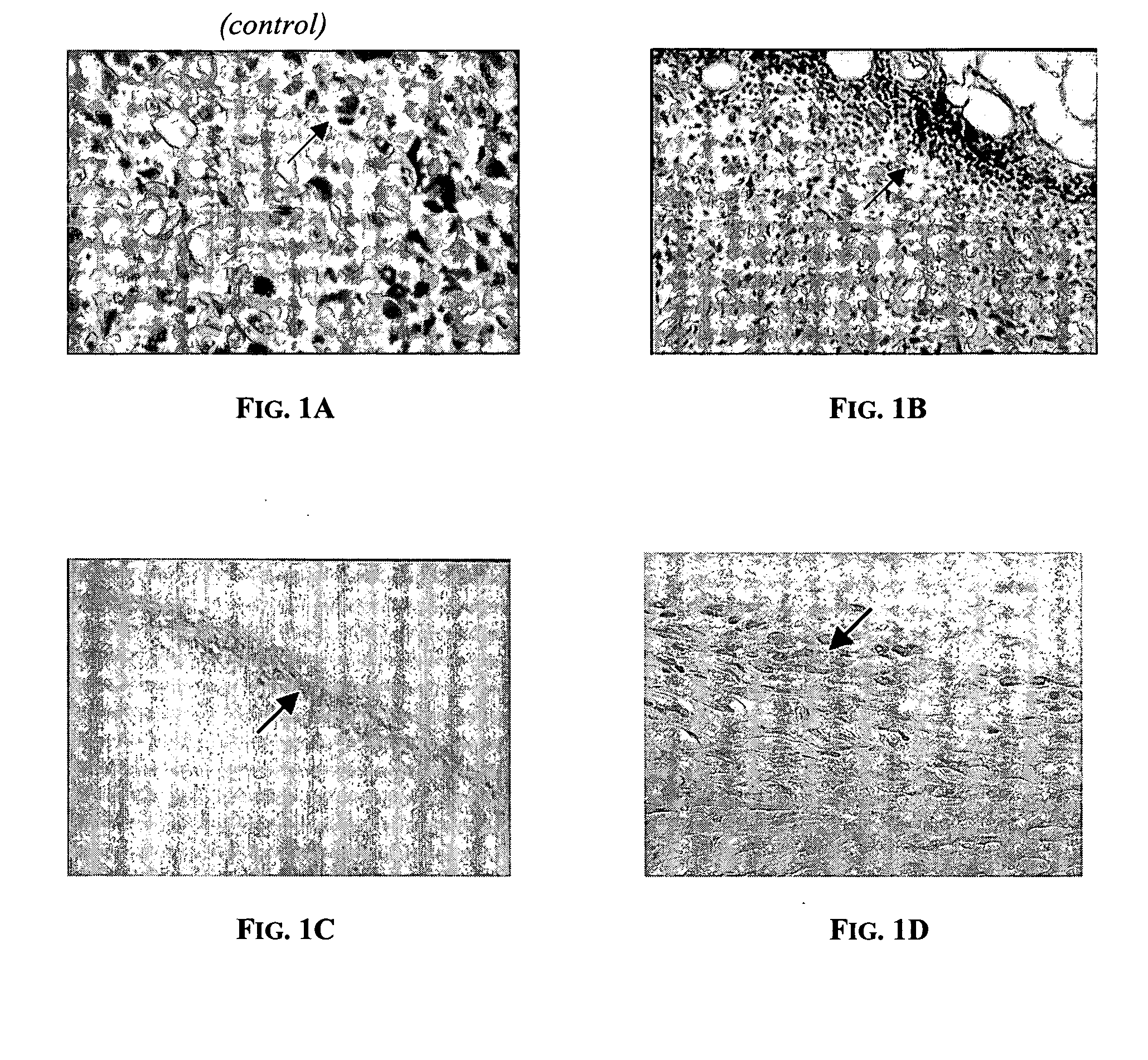 Method of modulating immune response by administration of immuno-activation agent