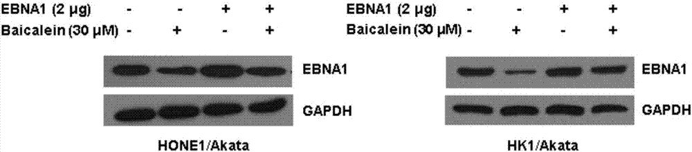 Application of baicalein to preparation of drug for preventing and/or treating nasopharyngeal carcinoma