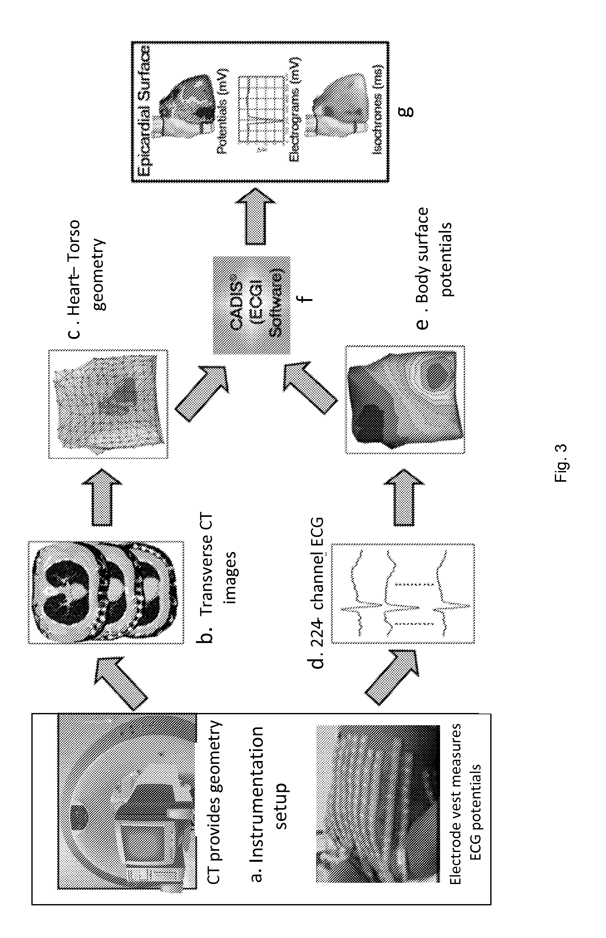 System and method for noninvasive electrocardiographic imaging (ECGI)