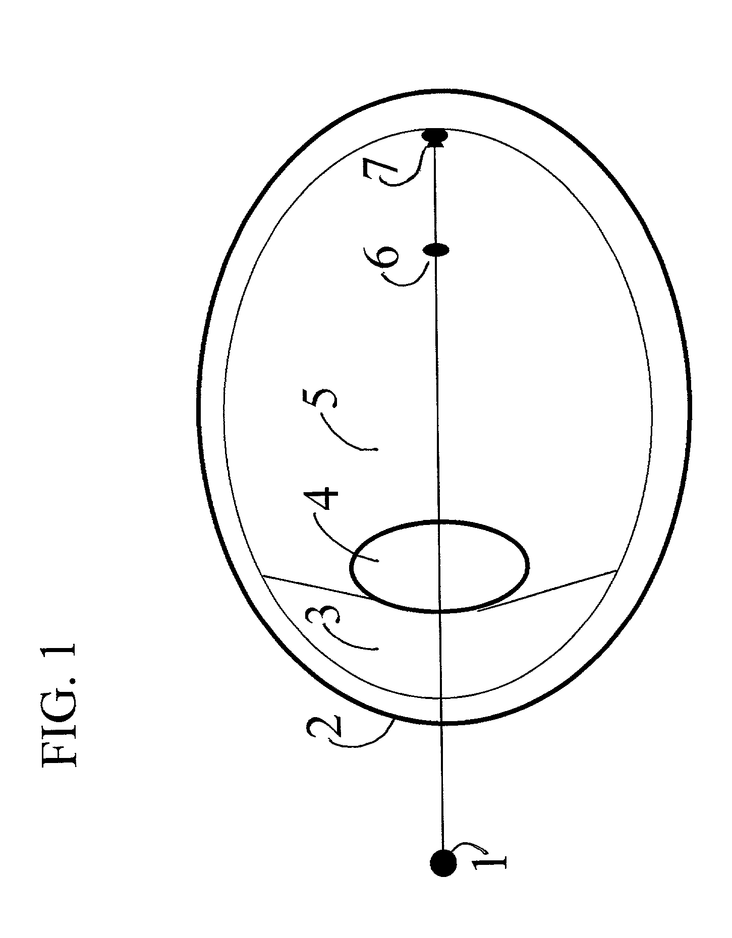 Apparatus and methods for vision correction using refractive index effects