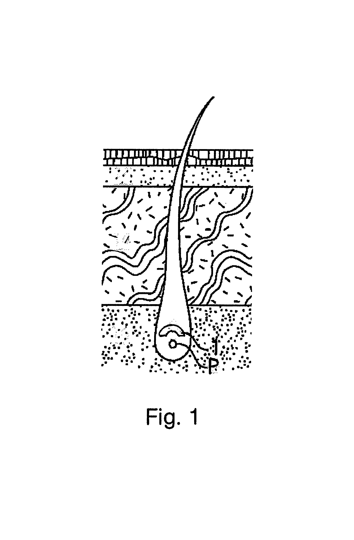 Method and apparatus for hair growth management