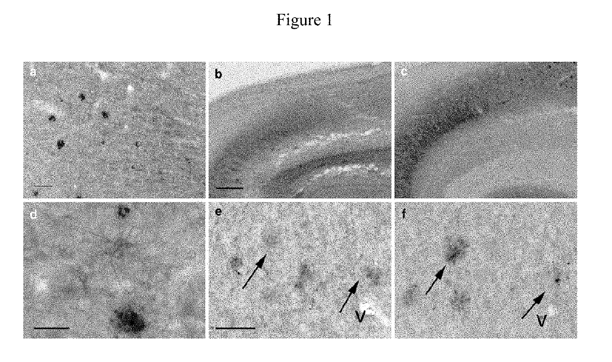 Identification of granins as the pathogenic factor of alzheimer's disease and compositions and methods for inhibiting granin aggregation and treating alzheimer's disease