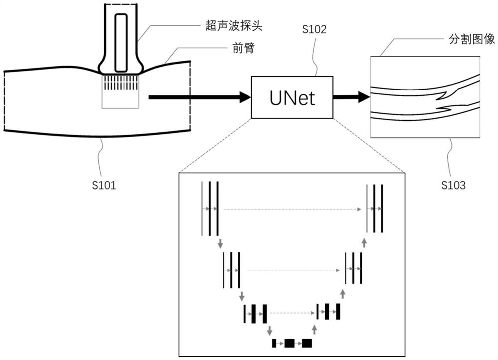 Vein puncture robot operation trajectory planning method based on ultrasonic image guidance