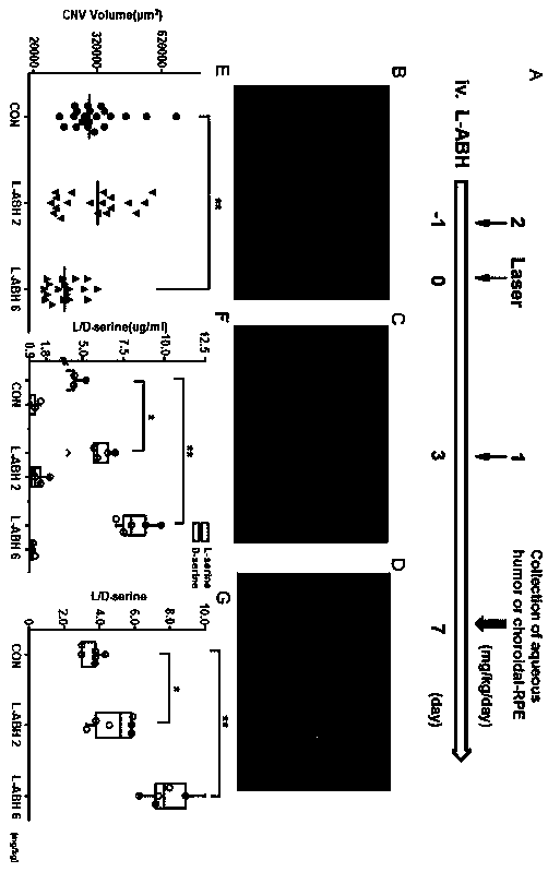 Application of L-aspartic acid beta-hydroxamate in preparation of drugs for inhibiting choroidal neovascularization, and choroidal neovascularization treatment method